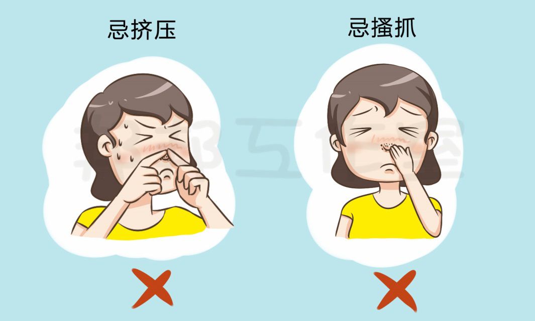 长黑头粉刺该怎么快速去除,鼻子上的黑头特别多该怎么去除