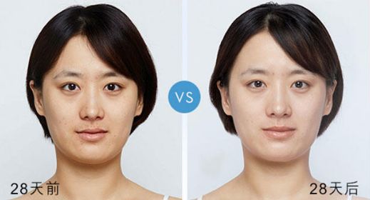 国货美白好物推荐,想美白用水乳还是精华