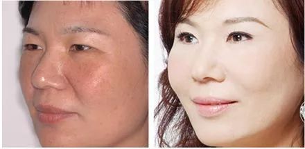 片仔癀珍珠膏臻润级40g (片仔癀珍珠膏新款旧款)