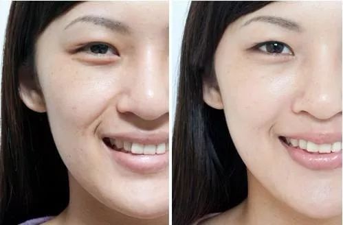 片仔癀珍珠膏臻润级40g (片仔癀珍珠膏新款旧款)