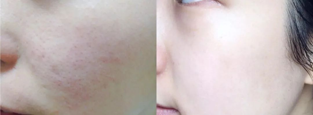 片仔癀珍珠膏臻润级40g (片仔癀珍珠膏新款旧款)