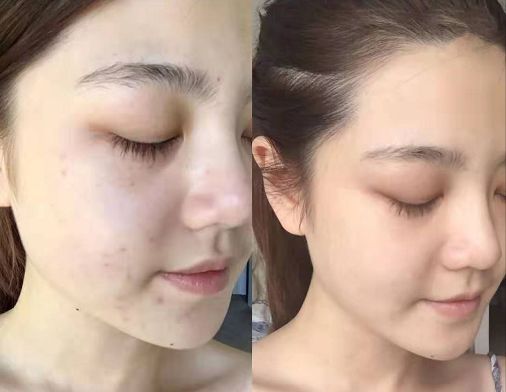 片仔癀珍珠膏臻润级40g (片仔癀珍珠膏新款旧款)