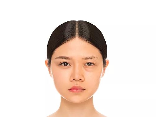 有没有人用眼霜黑眼圈更严重,黑眼圈用了眼霜过段时间就废了