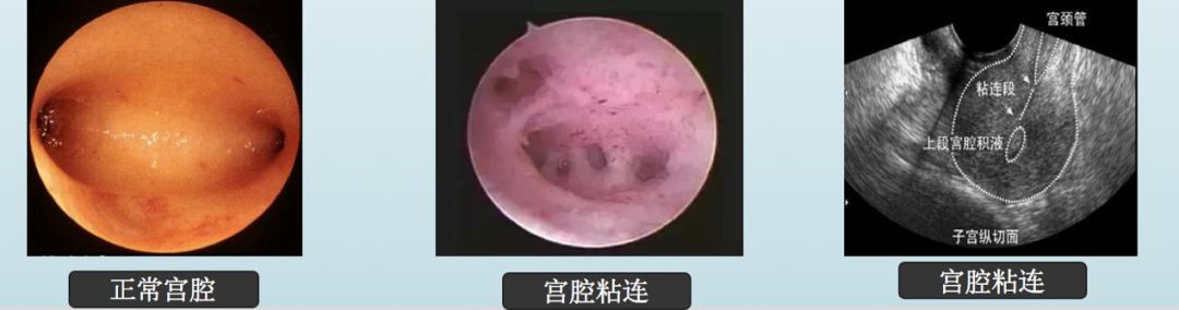 人流危害讲解视频3分钟,人流危害科普短片