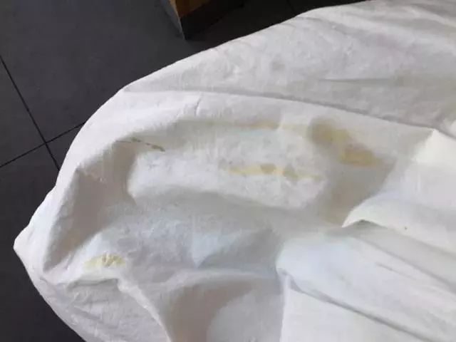 白色衣服长霉斑用什么可以除掉,衣服上有黄色霉斑怎么清洗最有效