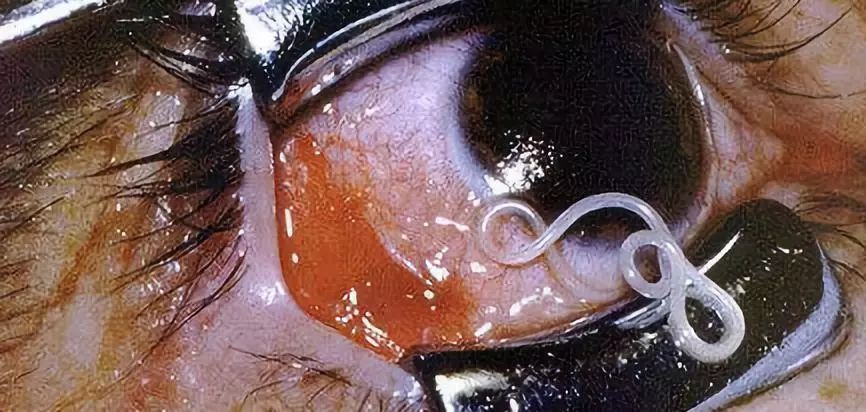 眼睛长虫子的前兆,有眼睛的恐怖的虫子