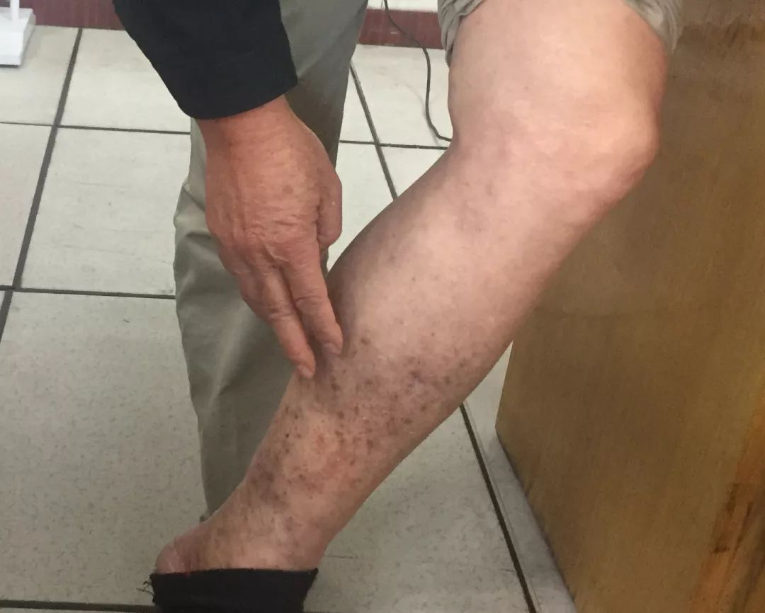 不得不防！大多数中老年人都有这个毛病生活中这些习惯要改掉......