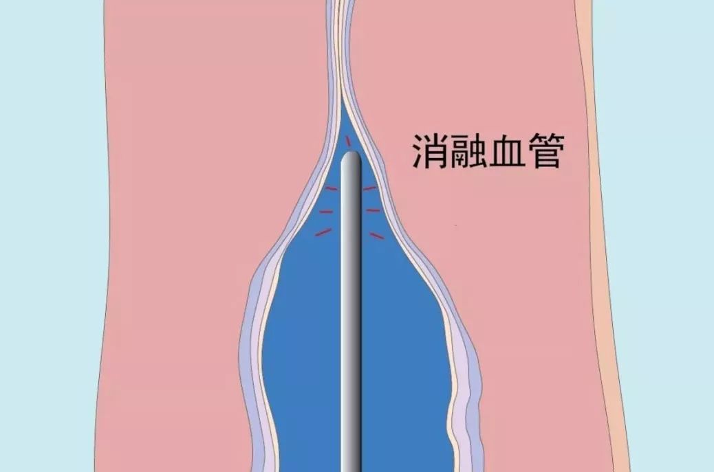 不得不防！大多数中老年人都有这个毛病生活中这些习惯要改掉......