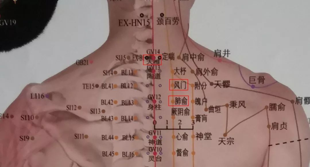 华佗治疗过敏性鼻炎秘方,古方专业治鼻炎
