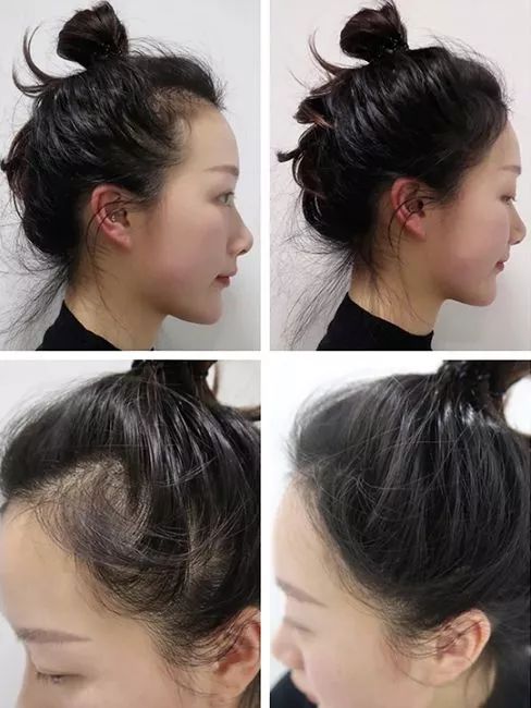 团|你的头发一根都不许掉！用它，还能3天不洗头依然干爽不油腻