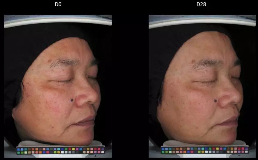 真正变白变美的方式竟然是这样,5个变白小技巧