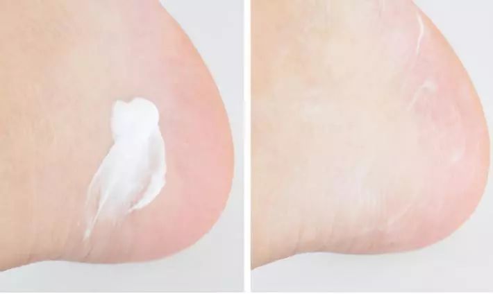 足部护理保湿防干裂去死皮,干燥足部保湿霜