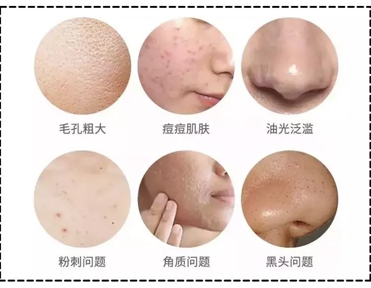 周冬雨17岁是什么样子,周冬雨17岁年轻时