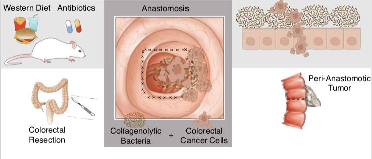 10月，33篇必读微生物研究：癌症、微生物药物、脑肠轴、皮肤-肠道轴、共生病毒、阴道微生物、菌群免疫互作、肠道黏液、粪菌移植