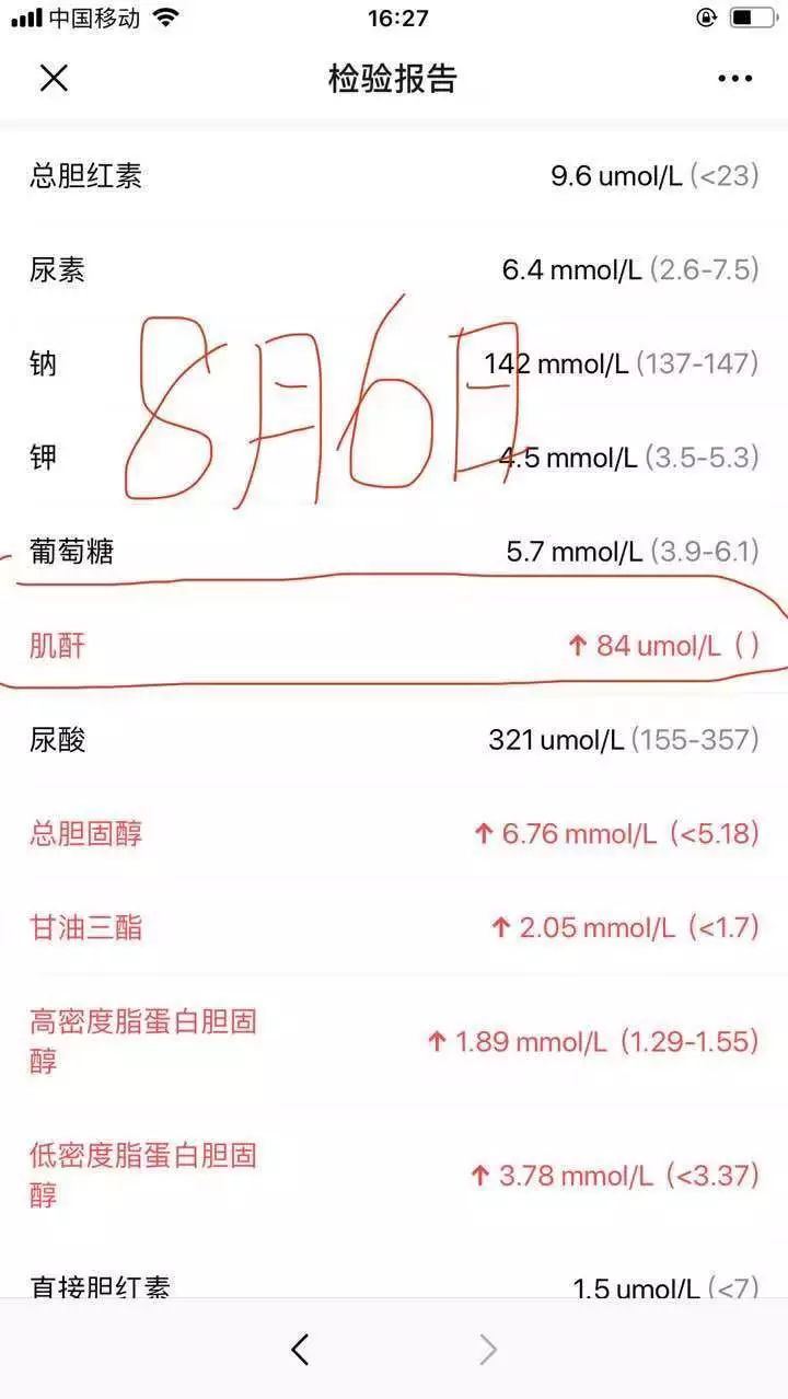 他汀类降脂药对肾功能有啥影响,高脂血症禁忌药