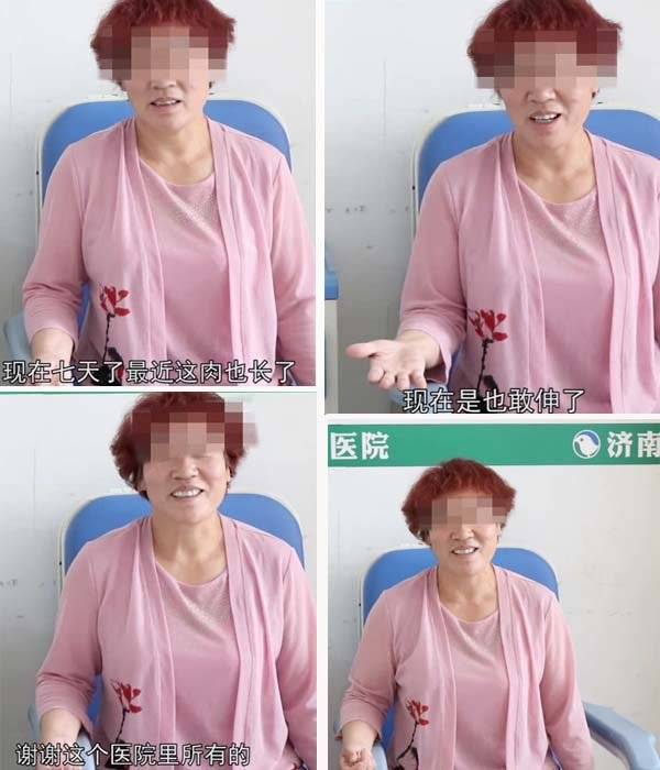 重度肌肉萎缩护理,肌肉萎缩的病人饮食怎么调理