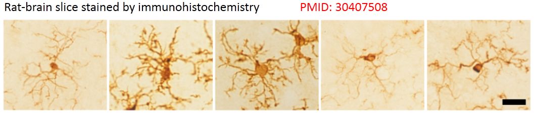 不得不知道的免疫组织化学常见问题及处理方法