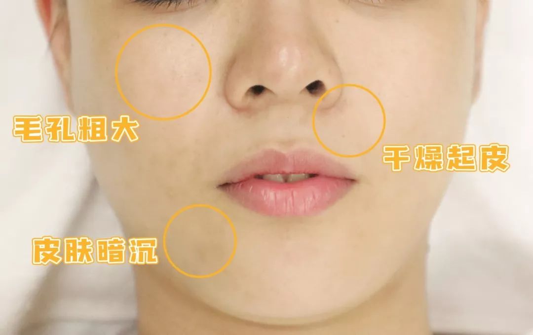 1元体验“爱马仕”级的变美服务,限量100份,再不抢就没了