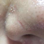 1元体验“爱马仕”级的变美服务，限量100份，再不抢就没了