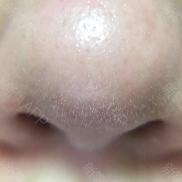 1元体验“爱马仕”级的变美服务,限量100份,再不抢就没了