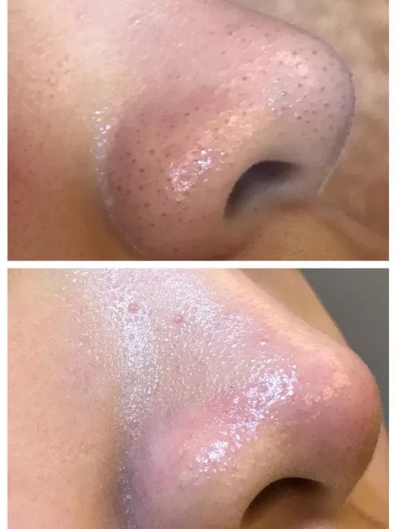 1元体验“爱马仕”级的变美服务,限量100份,再不抢就没了