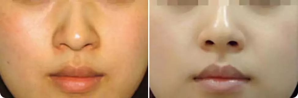 1元体验“爱马仕”级的变美服务,限量100份,再不抢就没了