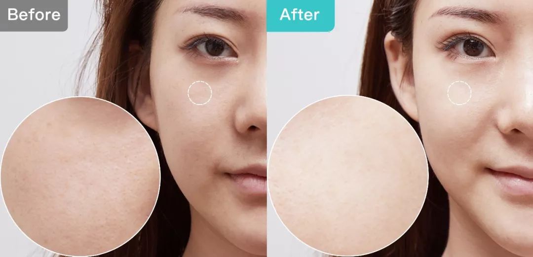 1元体验“爱马仕”级的变美服务,限量100份,再不抢就没了