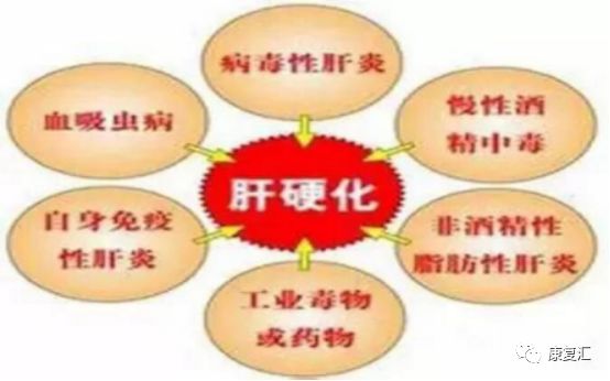 肝硬化康复期中医辨证,肝硬化腹水能彻底康复吗