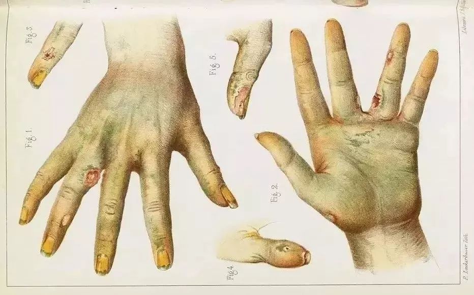 梦到克莱因蓝,梦见克莱因