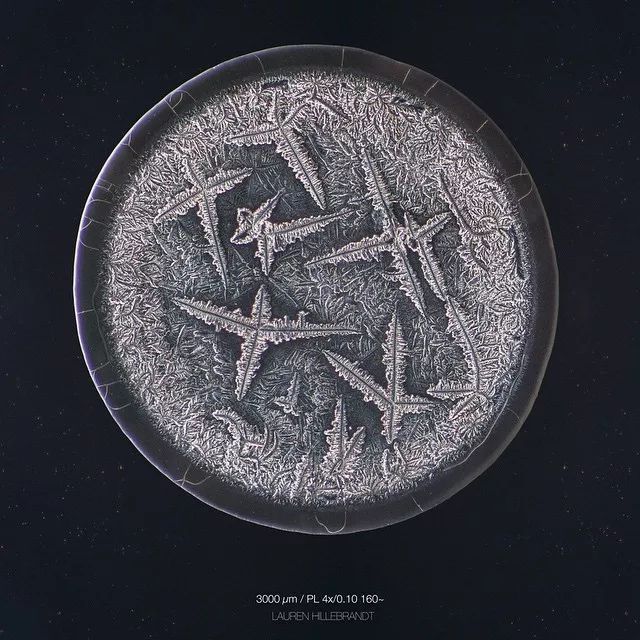 显微镜下的各种眼泪,显微镜下的眼泪原版