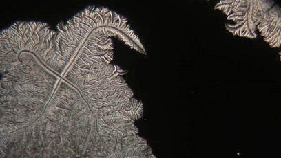 显微镜下的各种眼泪,显微镜下的眼泪原版