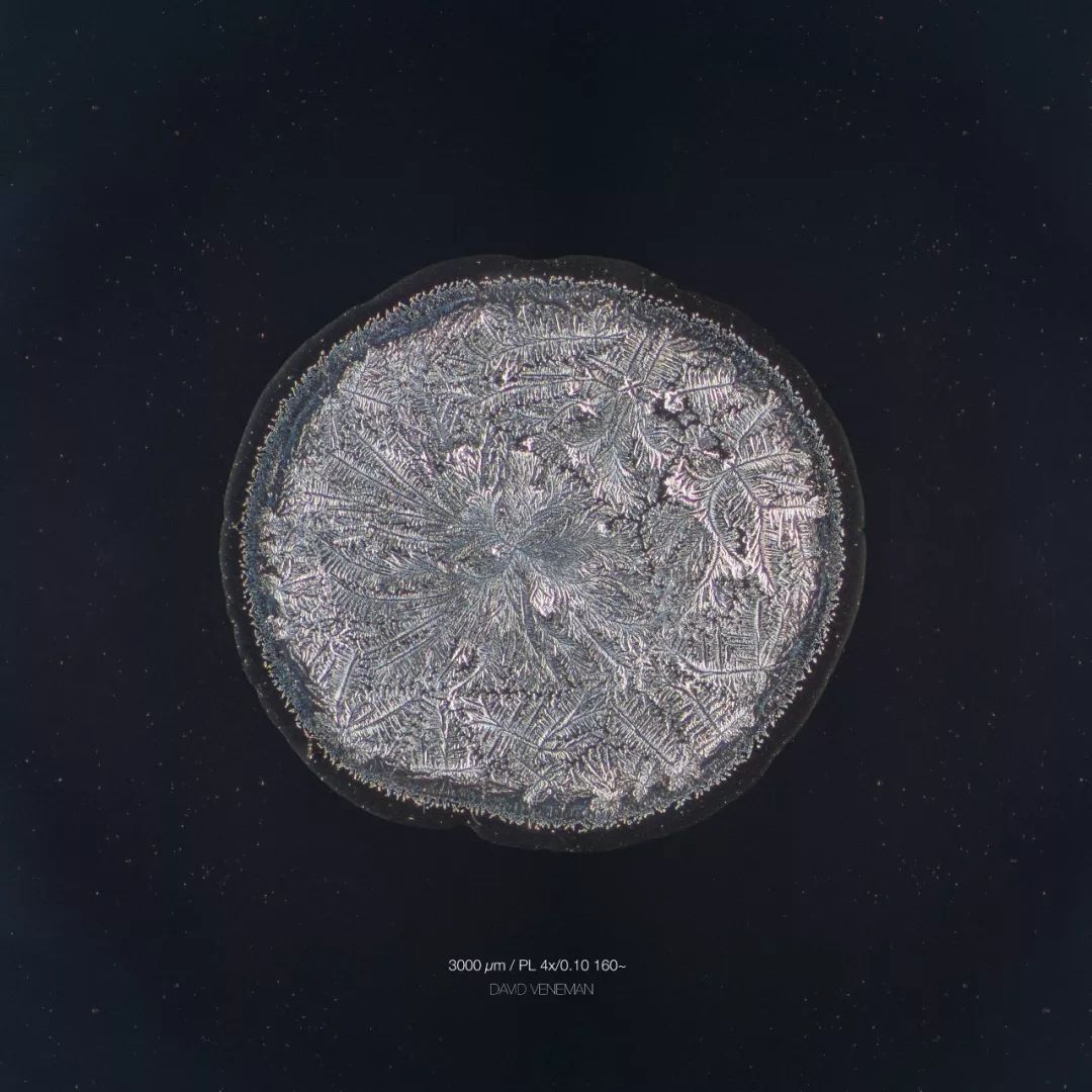 显微镜下的各种眼泪,显微镜下的眼泪原版