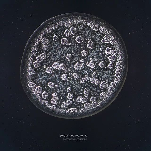 显微镜下的各种眼泪,显微镜下的眼泪原版