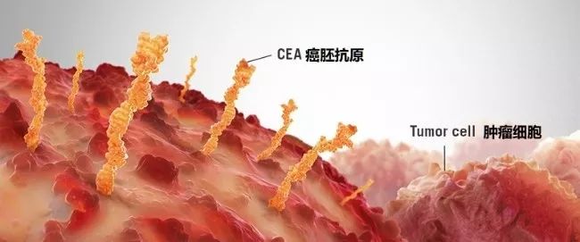 为什么照ct没变化癌胚抗原升高呢,癌症手术后癌胚抗原升高