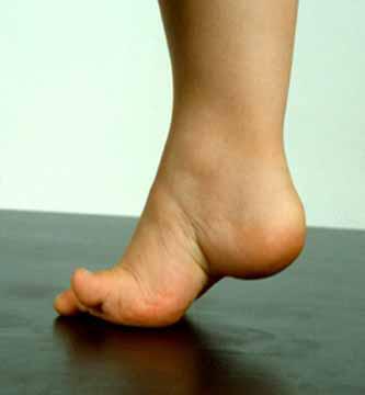 足底足跟痛,足底踮脚疼