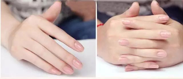 不要让你暴露你的年龄,别让皮肤暴露了你的年龄