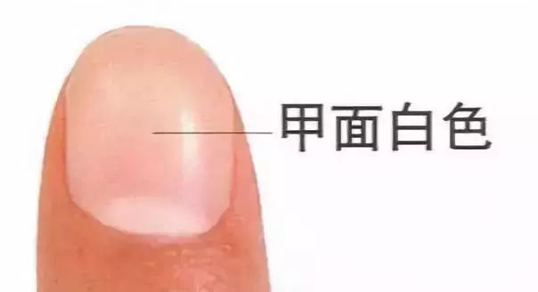 科普|指甲的状态反映了你身体的状况