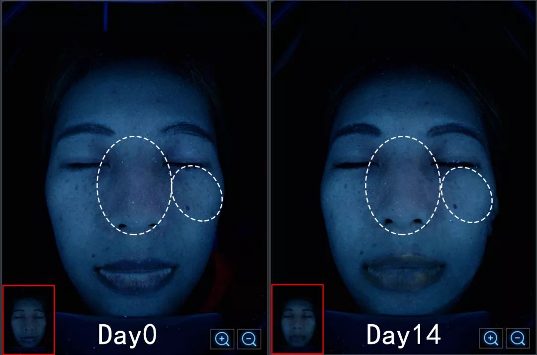 盲测|微整不急!先试试黑科技抗老面霜
