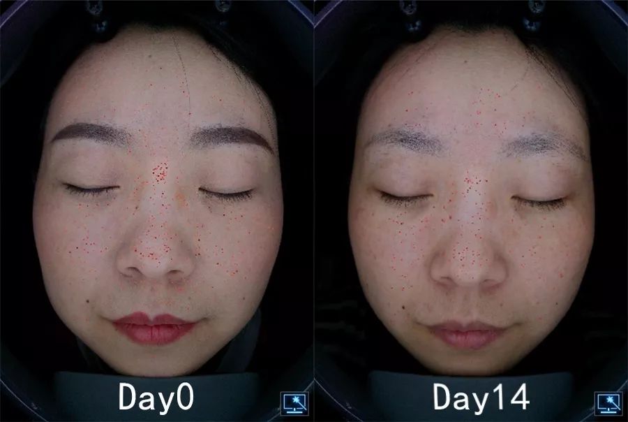 盲测|微整不急!先试试黑科技抗老面霜