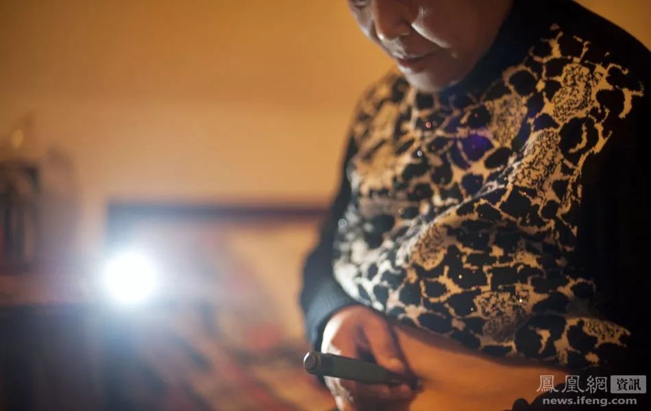 癌症患者挂尿袋和屎袋,患癌人身上带着尿袋