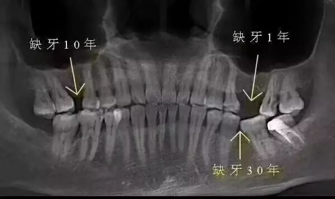 看牙惠民补贴,市民申领看牙补贴套路