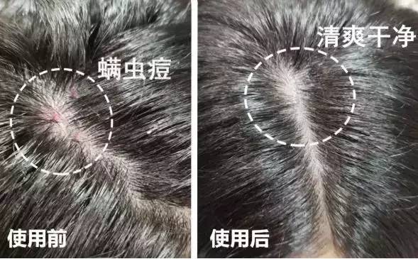 国货之光农科院生发水,国货之光农科院护肤品