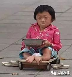 眼球被挖男孩案,孩子被拐走挖器官案例