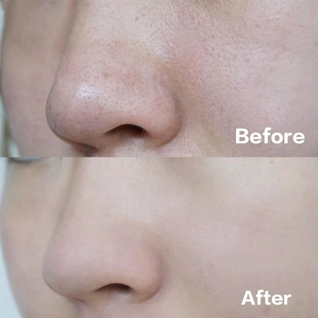 堪比“吸尘器”的洁面皂,洗净黑头去油脂,肌肤细腻滑溜溜