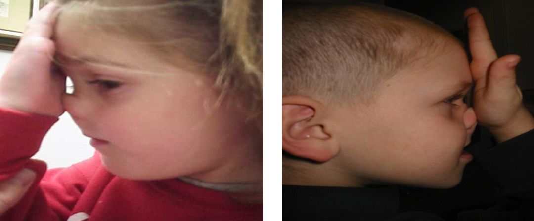 过敏性鼻炎日常生活需要注意什么,过敏性鼻炎平时饮食要注意什么