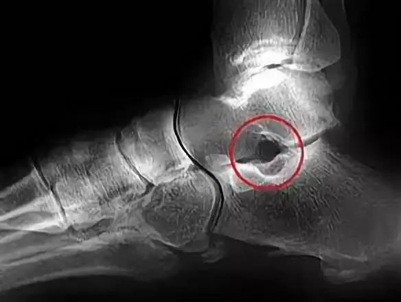 「临床干货」值得熟记，解剖基础知识点合集