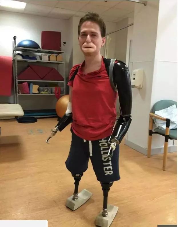 男子被恙虫咬致器官衰竭,男子惨遭蟒蛇吃掉险丧命