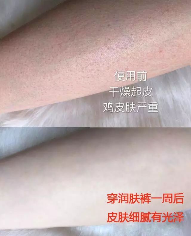 把护肤品穿在腿上是种什么体验?还能「显瘦10斤+超级保暖」