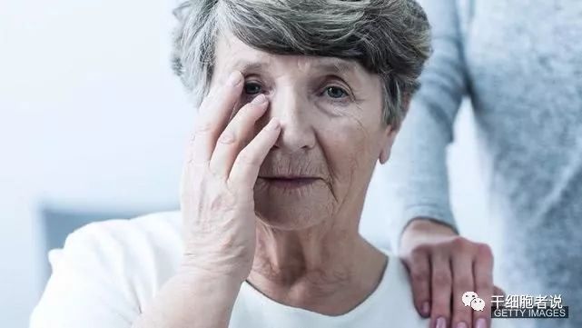 干细胞治疗阿尔茨海默的文献,阿尔茨海默病应用干细胞治疗