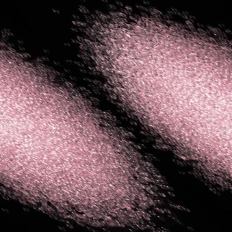 胶原蛋白埋线如何操作,胶原蛋白埋线真的有用吗